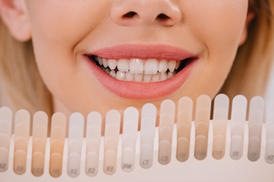 smiling woman displaying teeth shade guide with eight color samples for dental aesthetics